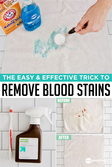 does peroxide remove blood stains.